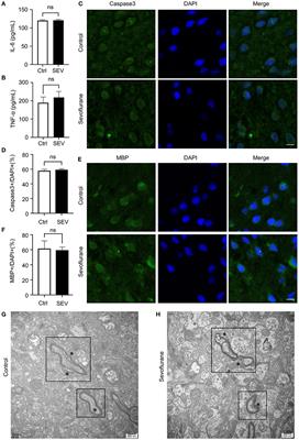 The Effect of Sevoflurane Anesthesia on the Biomarkers of Neural Injury in the Prefrontal Cortex of Aged Marmosets